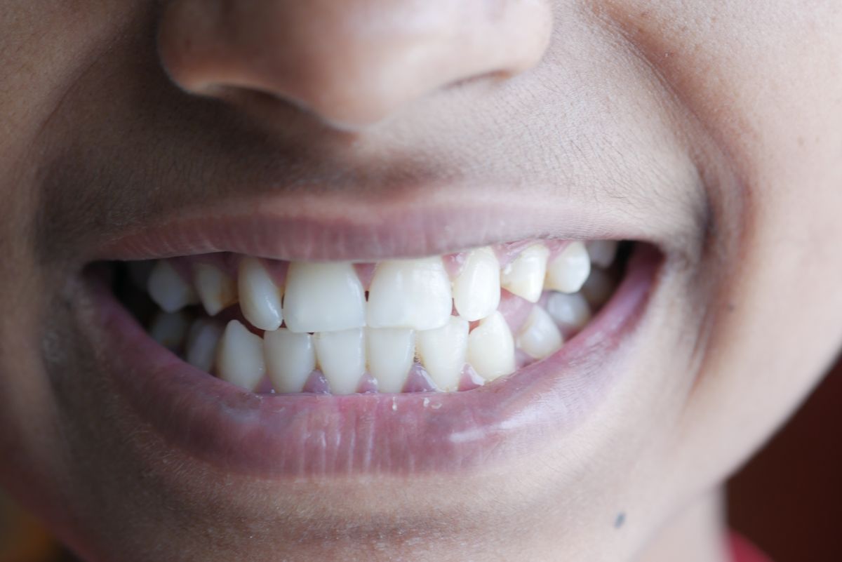 Bright natural smile